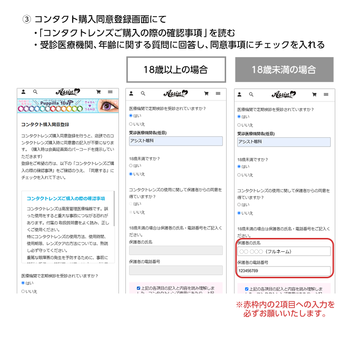 コンタクト購入同意登録画面の確認と同意事項にチェック